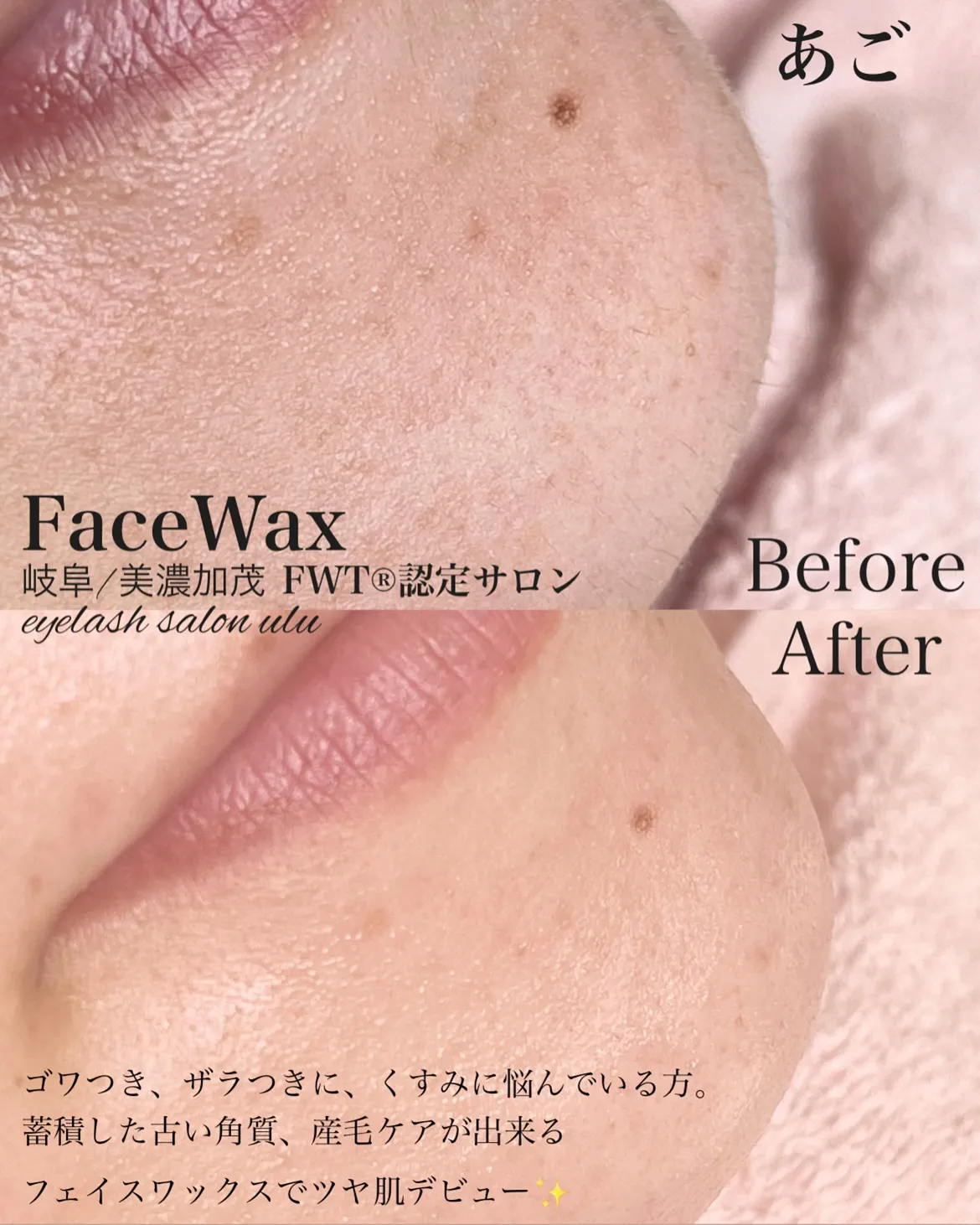 古い角質、ため込んでいませんか?